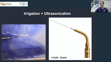 Load image into Gallery viewer, Irrigation protocol, intracanal medications