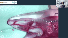 Load image into Gallery viewer, Online course on primary endodontic treatment - 8 hours CE credit