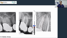 Load image into Gallery viewer, Online course on primary endodontic treatment - 8 hours CE credit