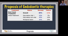 Load image into Gallery viewer, Prognosis of Primary Endodontic Treatment