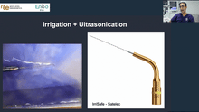 Load image into Gallery viewer, Irrigation protocol, intracanal medications

