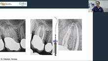 Load image into Gallery viewer, Online course on primary endodontic treatment - 8 hours CE credit
