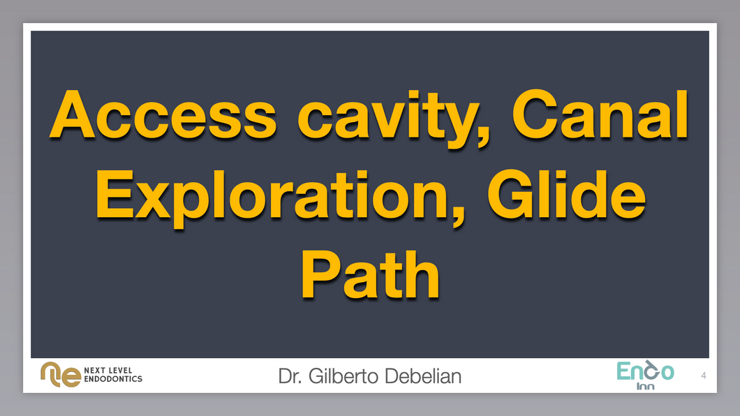 Access cavity, Canal Exploration, Glidepath