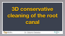 Load image into Gallery viewer, 3D conservative cleaning of the root canal
